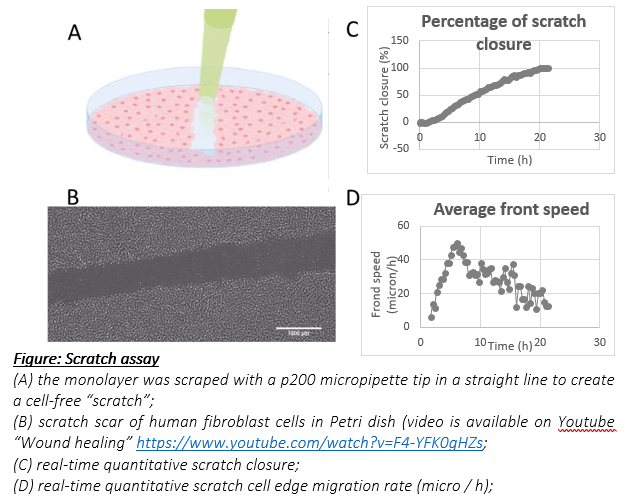 Cell Migration Assay