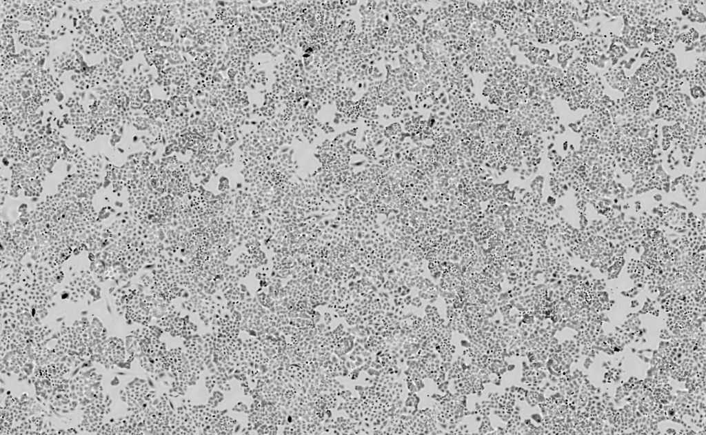 RESULTS-LIVE-CELL-IMAGING-WITH-HORUS-CYTONOTE-IPRASENSE-02