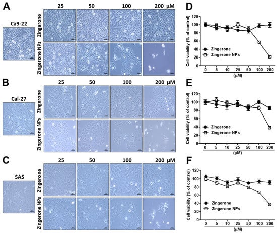 Phytochemically Derived Zingerone Nanoparticles Inhibit Cell Proliferation, Invasion and Metastasis in Human Oral Squamous Cell Carcinoma Figure 01